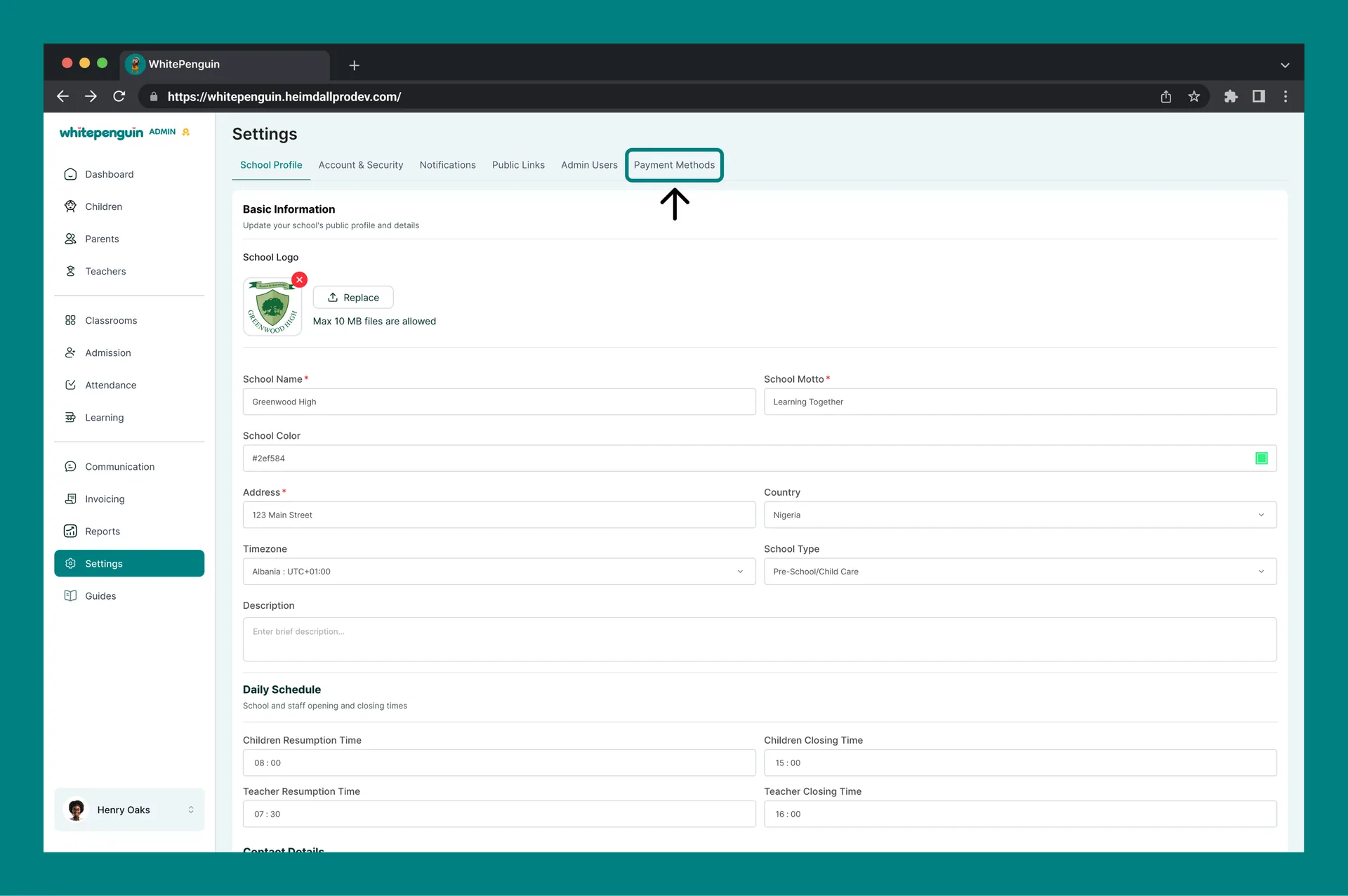 Setup Payment Methods — How to Access
